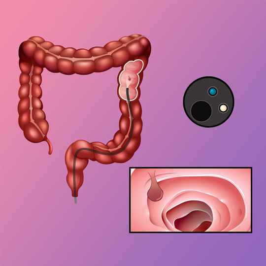 Colonoscopia en Panamá