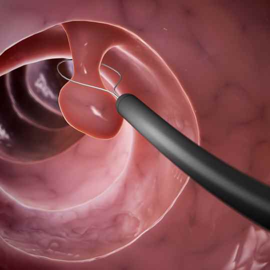 Procedimientos endoscópicos en Panamá